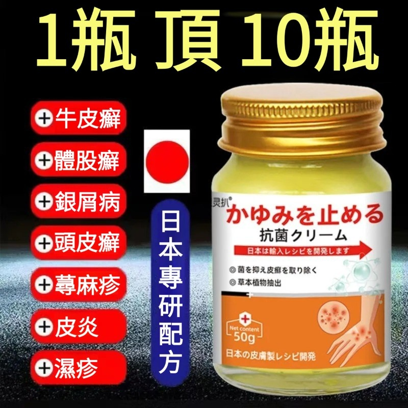 日本膚癬抗菌乳膏，專用頑固牛皮癬、銀屑、濕疹、皮炎，草本配方，止癢效果加倍，1瓶頂10瓶，塗抹快速止癢，皮炎牛皮癬不反復