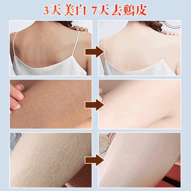 凡士林去雞皮煥亮身體乳,一瓶改善粗糙肌膚!滋潤嫩白,煥發肌膚青春態,全身滋養,持久留香,肌膚嫩滑香甜,更迷人,閃耀每一刻! 凡士林去雞皮煥亮身體乳,一瓶改善粗糙肌膚!滋潤嫩白,煥發肌膚青春態,全身滋養,持久留香,肌膚嫩滑香甜,更迷人,閃耀每一刻!