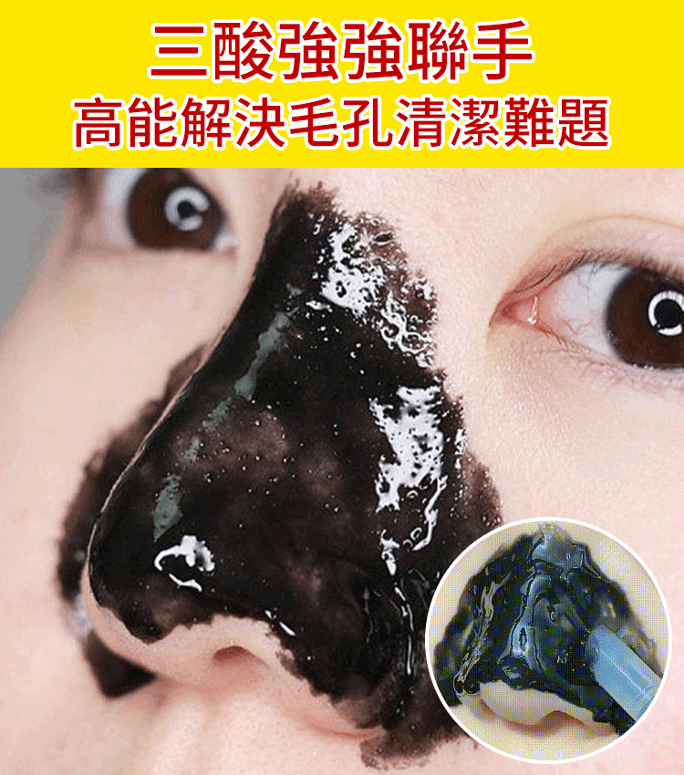 抖音爆款黑頭清潔分解棒 國民級清潔黑頭好物風靡全球累計種草300萬＋