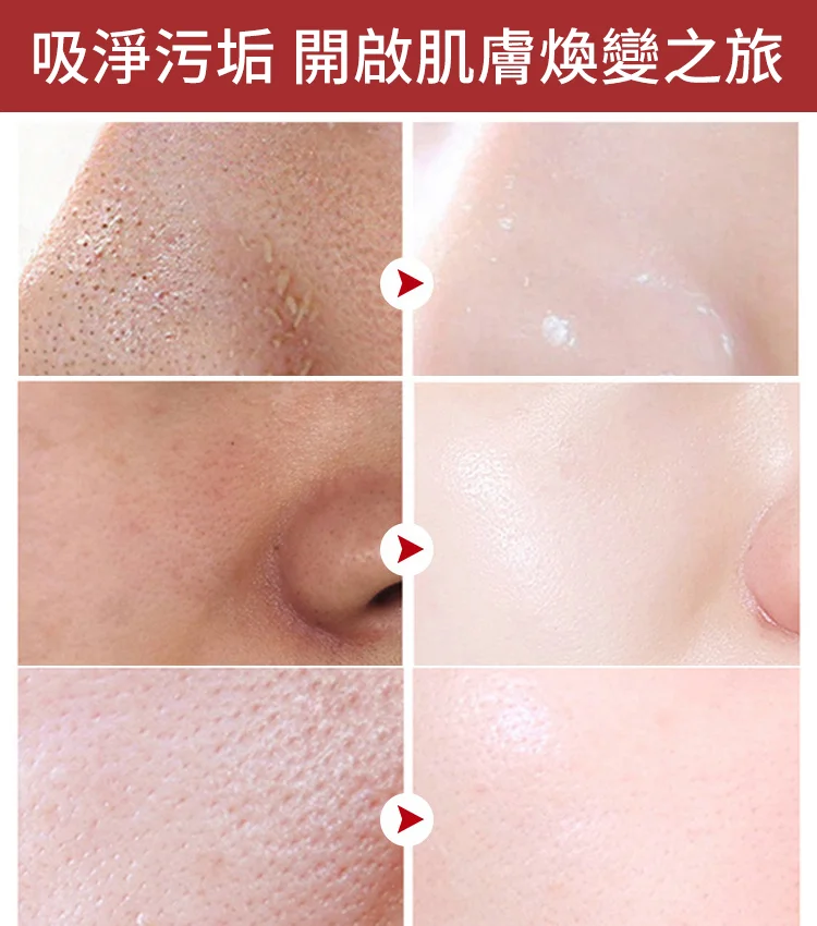 抖音爆款黑頭清潔分解棒 國民級清潔黑頭好物風靡全球累計種草300萬＋