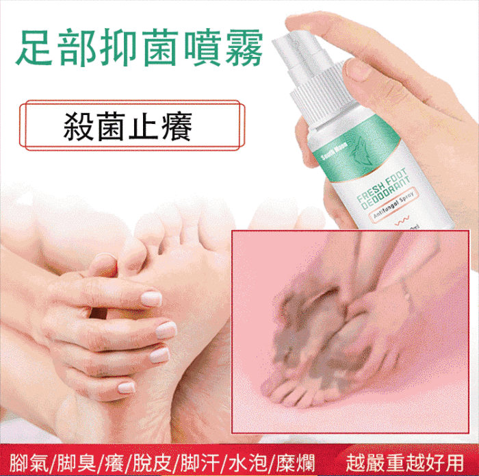 專攻腳氣，一噴搞定腳癢 足部殺菌除癬噴霧