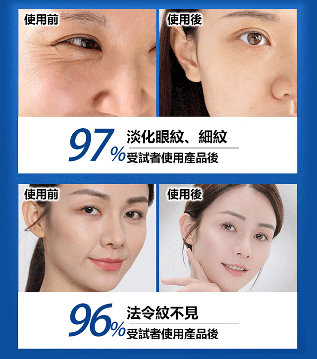 【日本技術】水光抗皺精華霜 28天消除皺紋 守護年輕水光抗皺精華霜